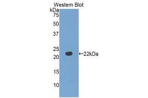 Western Blotting (WB) image for anti-Fibulin 5 (FBLN5) (AA 277-448) antibody (ABIN1858822) (Fibulin 5 Antikörper  (AA 277-448))