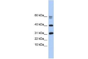 LOC339047 antibody used at 1 ug/ml to detect target protein. (LOC339047 Antikörper  (Middle Region))