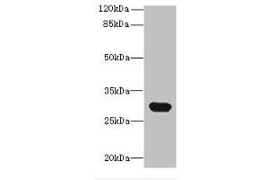 Western blot All lanes: C1QTNF6 antibody at 8 μg/mL + Mouse brain tissue Secondary Goat polyclonal to rabbit IgG at 1/10000 dilution Predicted band size: 29, 31, 18 kDa Observed band size: 29 kDa (CTRP6 Antikörper  (AA 47-278))