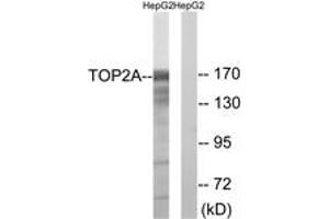 Western blot analysis of extracts from HepG2 cells, using TOP2A (Ab-1343) Antibody. (Topoisomerase II alpha Antikörper  (AA 1311-1360))