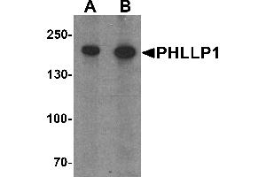 Western blot analysis of PHLPP1 in SW480 cell lysate with PHLPP1 antibody at (A) 1 and (B) 2 µg/mL. (PHLPP1 Antikörper  (N-Term))