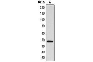 Western blot analysis of ARRDC1 expression in MDAMB231 (A) whole cell lysates. (ARRDC1 Antikörper  (Center))