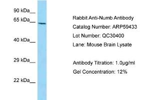 Western Blotting (WB) image for anti-Numb Homolog (NUMB) (C-Term) antibody (ABIN2788064)