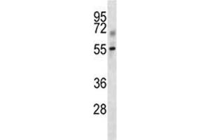 Western Blotting (WB) image for anti-Transforming Growth Factor, beta Receptor 1 (TGFBR1) (AA 141-169) antibody (ABIN3029222)