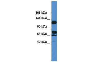 Western Blot showing ST5 antibody used at a concentration of 1. (ST5 Antikörper  (Middle Region))