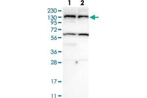 Western Blot analysis of (1) Human RT-4 cell, (2) Human U-251MG sp cell.