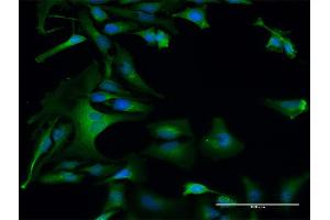 Immunofluorescence of purified MaxPab antibody to DAP3 on HeLa cell.