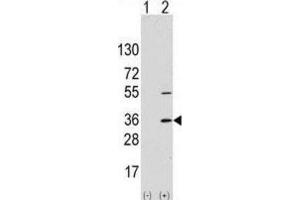 Western Blotting (WB) image for anti-Signal Sequence Receptor, alpha (SSR1) antibody (ABIN2997994) (SSR1 Antikörper)