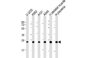 All lanes : Anti-UQCRFS1P1 Antibody (Center) at 1:2000 dilution Lane 1: U-2OS whole cell lysate Lane 2: K562 whole cell lysate Lane 3: A431 whole cell lysate Lane 4: A549 whole cell lysate Lane 5: human skeletal muscle lysate Lane 6: human placenta lysate Lysates/proteins at 20 μg per lane. (UQCRFS1P1 Antikörper  (AA 71-104))