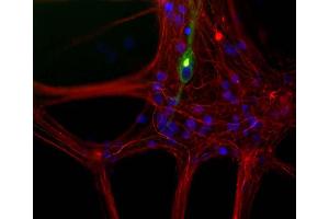 Mixed neuron/glia cultures from newborn rat brain stained with MCA-7C5 antibody to peripherin (green) and rabbit polyclonal antibody to NF-L ABIN1842266 (red channel). (NEFL Antikörper)
