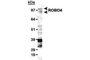 Western blot analysis of ROBO4 in HUVEC lysate with ROBO4 polyclonal antibody . (ROBO4 Antikörper  (AA 900-1007))