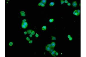 Immunofluorescence staining of PC-3 cells with ABIN7172586 at 1:200, counter-stained with DAPI. (NF-kB p65 Antikörper  (AA 1-210))