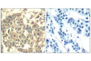 Image no. 2 for anti-Met Proto-Oncogene (MET) (AA 1001-1005) antibody (ABIN401653) (c-MET Antikörper  (AA 1001-1005))