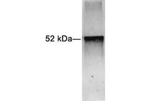 Western blot analysis of Glu-Glu-tag fusion protein using 1 µg/mL Rabbit Anti-Glu-Glu-tag Polyclonal Antibody (ABIN398451) The signal was developed with IRDyeTM 800 Conjugated Goat Anti-Rabbit IgG Antibody (Glu-Glu Tag Antikörper)