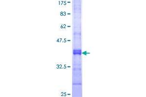 AMPD2 Protein (AA 86-185) (GST tag)