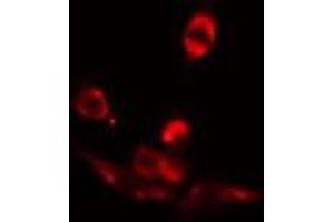 ABIN6272413 staining COLO205 by IF/ICC. (RFX3 Antikörper  (C-Term))