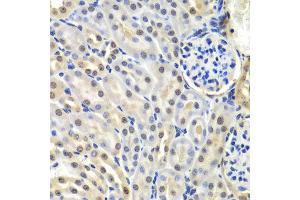 Immunohistochemistry of paraffin-embedded mouse kidney using SNRPD2 antibody at dilution of 1:100 (x40 lens). (SNRPD2 Antikörper)