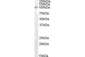 ABIN238682 (1µg/ml) staining of Human Kidney lysate (35µg protein in RIPA buffer).