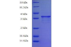 SDS-PAGE (SDS) image for Zinc Finger Protein 26 (ZNF26) (AA 335-533), (partial) protein (His-SUMO Tag) (ABIN4974799)