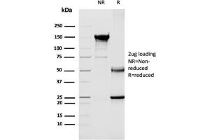 SDS-PAGE Analysis Purified CD40 Ligand Mouse Monoclonal Antibody (CD40LG/2763). (CD40 Ligand Antikörper  (AA 108-261))