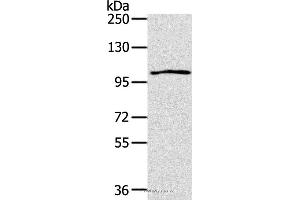 Western blot analysis of K562 cell, using IL17RA Polyclonal Antibody at dilution of 1:200