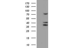 HEK293T cells were transfected with the pCMV6-ENTRY control (Left lane) or pCMV6-ENTRY CYP2B6 (Right lane) cDNA for 48 hrs and lysed. (CYP2B6 Antikörper)