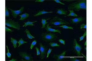 Immunofluorescence of monoclonal antibody to USP9X on HeLa cell. (USP9X Antikörper  (AA 1-90))