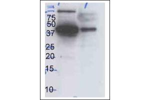 Western Blotting (WB) image for anti-Mitogen-Activated Protein Kinase 1/3 (MAPK1/3) antibody (ABIN371670) (ERK1/2 Antikörper)