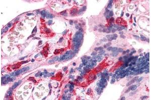 anti-Hematopoietic Cell-Specific Lyn Substrate 1 (HCLS1) (AA 266-356) antibody