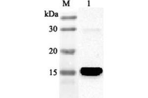 Western blot analysis using anti-FABP4 (human), pAb  at 1:2'000 dilution. (FABP4 Antikörper)