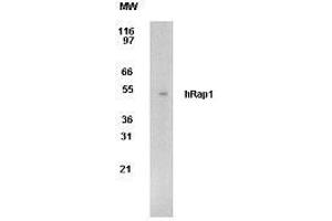 Image no. 1 for anti-Telomeric Repeat Binding Factor 2, Interacting Protein (TERF2IP) (AA 212-235) antibody (ABIN208205)