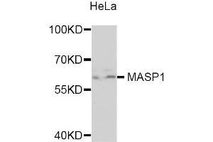 Western blot analysis of extracts of HeLa cells, using MASP1 antibody. (MASP1 Antikörper)