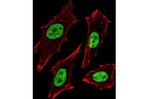 Fluorescent image of Hela cells stained with MGMT Antibody B.