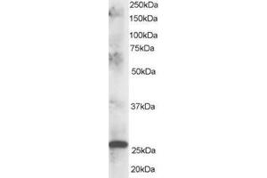 Image no. 1 for anti-ClpP Caseinolytic Peptidase, ATP-Dependent, Proteolytic Subunit Homolog (E. Coli) (CLPP) (C-Term) antibody (ABIN374308) (CLPP Antikörper  (C-Term))