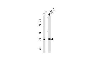 Western blot analysis in 293,MCF-7 cell line lysates (35ug/lane). (CA2 Antikörper  (C-Term))