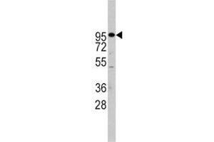 Western Blotting (WB) image for anti-ADAM Metallopeptidase Domain 17 (ADAM17) (AA 794-823) antibody (ABIN3029859)