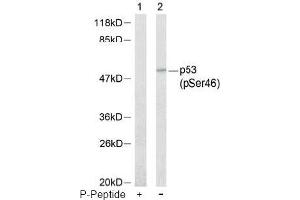 Image no. 1 for anti-Tumor Protein P53 (TP53) (pSer46) antibody (ABIN196787) (p53 Antikörper  (pSer46))