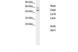 Image no. 2 for anti-GC-Rich Promoter Binding Protein 1 (GPBP1) (AA 67-116) antibody (ABIN6736275)