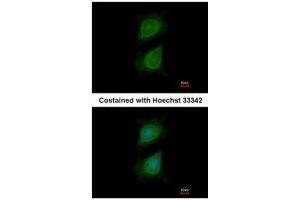 ICC/IF Image Immunofluorescence analysis of methanol-fixed HeLa, using Plexin D1, antibody at 1:500 dilution. (PLXND1 Antikörper  (C-Term))