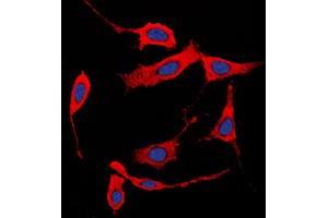 Immunofluorescent analysis of Collagen 1 alpha 2 staining in HeLa cells. (COL1A2 Antikörper  (N-Term))