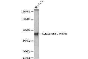 Western blot analysis of extracts of SH-SY5Y cells, using Cytokeratin 9 (KRT9) (KRT9) antibody (ABIN7268107) at 1:1000 dilution. (KRT9 Antikörper)