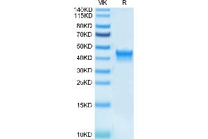 Biotinylated Human IL-2 R alpha on Tris-Bis PAGE under reduced condition. (CD25 Protein (AA 22-213) (His-Avi Tag,Biotin))