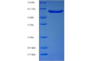 SDS-PAGE (SDS) image for Syntaphilin (SNPH) (AA 1-424), (partial) protein (His-SUMO Tag) (ABIN5710390) (Syntaphilin Protein (SNPH) (AA 1-424, partial) (His-SUMO Tag))
