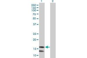 Lane 1: MRPL43 transfected lysate ( 17. (MRPL43 293T Cell Transient Overexpression Lysate(Denatured))