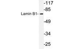 Western blot analysis of Lamin B1 antibody in extracts from COLO cells. (Lamin B1 Antikörper)