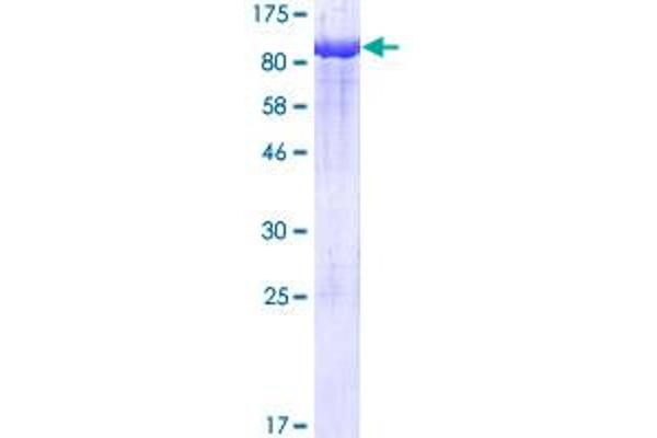 PCK1 Protein (AA 1-622) (GST tag)