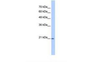 Image no. 1 for anti-Prostaglandin D2 Synthase (PTGDS) (N-Term) antibody (ABIN6738422) (PTGDS Antikörper  (N-Term))