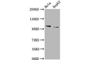 Western Blot Positive WB detected in: Hela whole cell lysate, HepG2 whole cell lysate All lanes: IKBKAP antibody at 5. (IKAP/p150 Antikörper  (AA 1107-1258))
