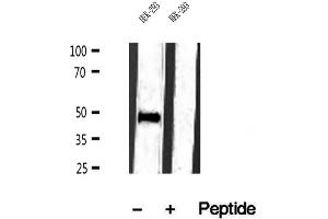 Western blot analysis of extracts of HEK-293 cells, using IFT57 antibody. (IFT57 Antikörper  (Internal Region))