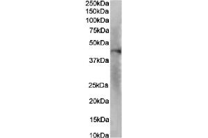Western Blot using anti-IL-8RA antibody SE2. (Rekombinanter CXCR2 Antikörper  (N-Term))